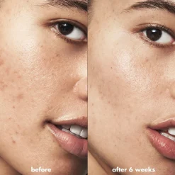 Blemish Breakthrough Acne Calming Water Cream
