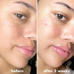 C-Brightening Putty Primer