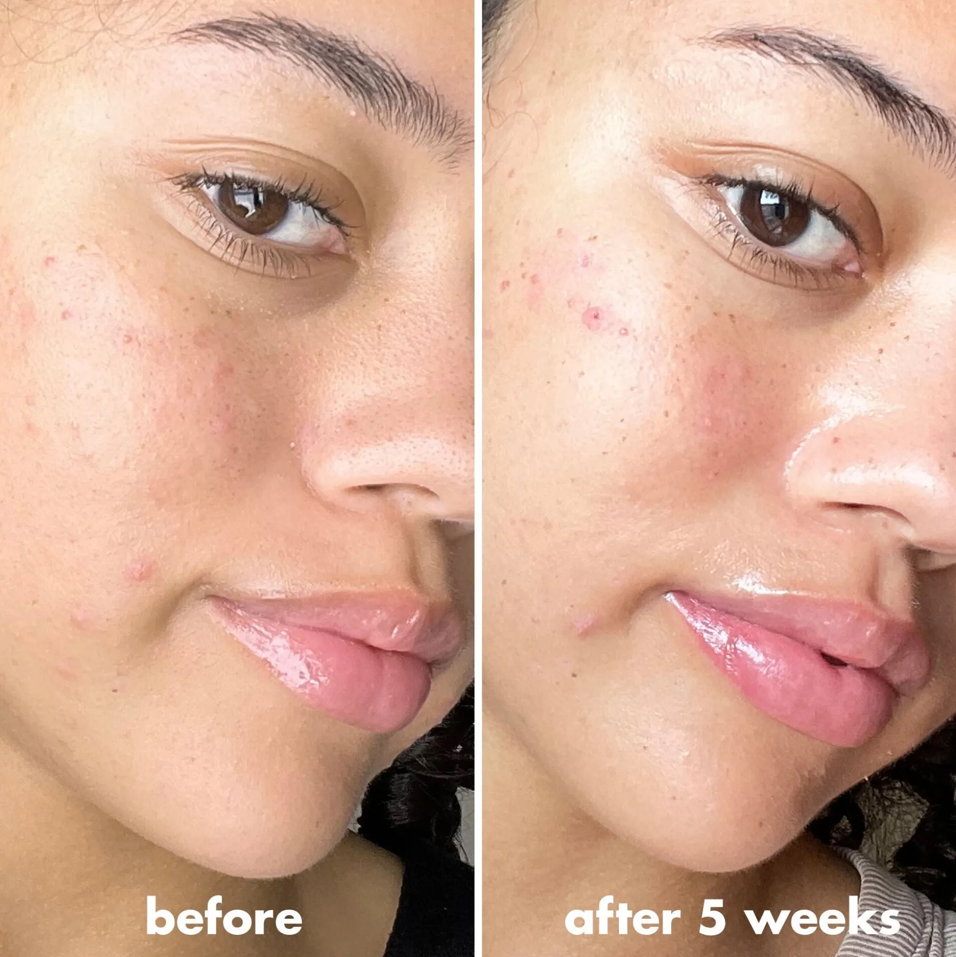 C-Brightening Putty Primer