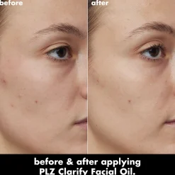 PLZ Clarify Facial Oil
