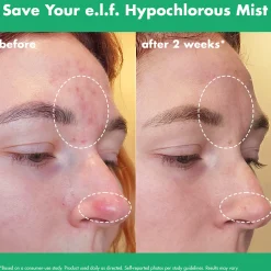 Save Your e.l.f. hypochlorous Mist
