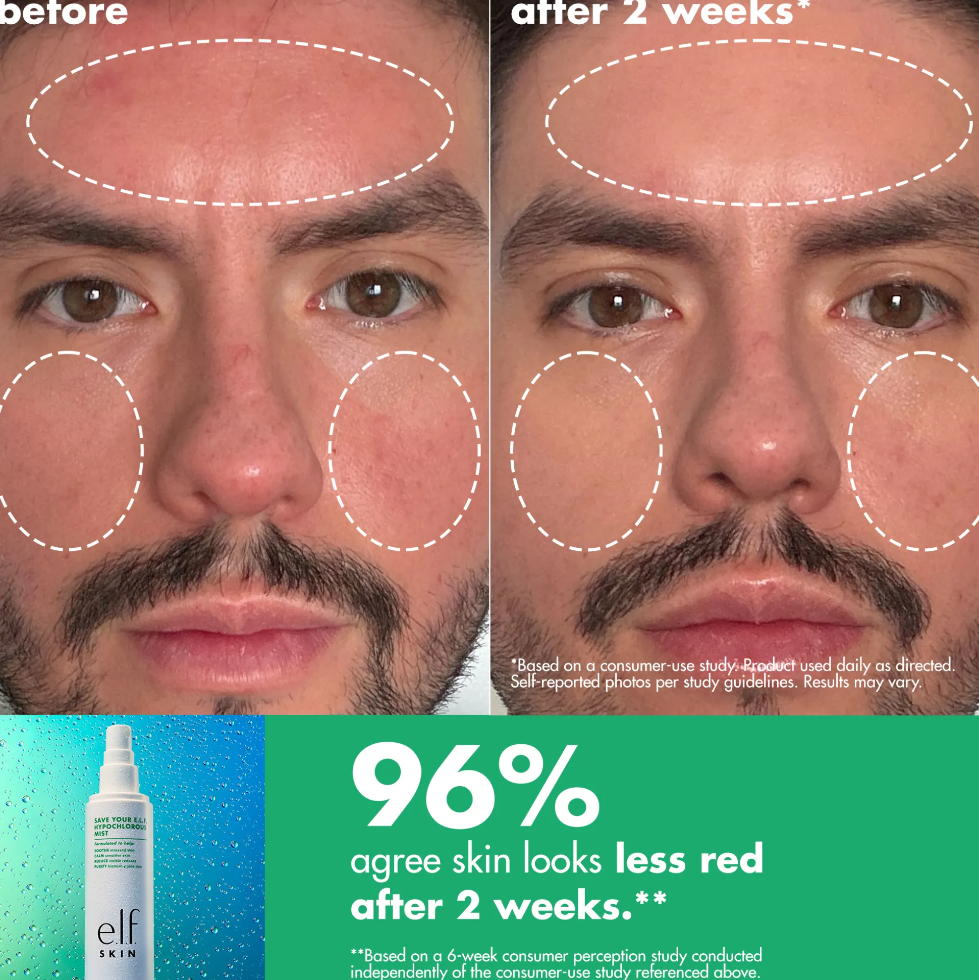 Save Your e.l.f. hypochlorous Mist